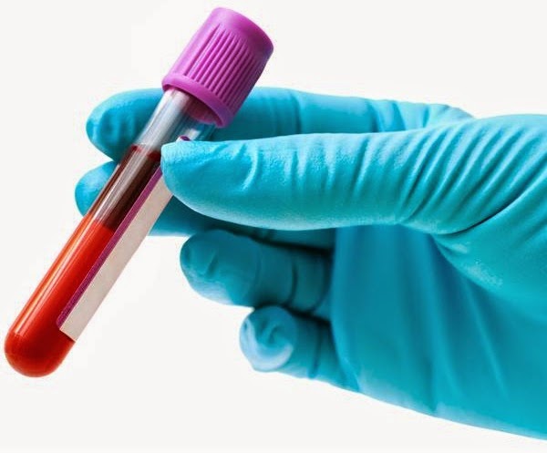 Mão com luva segurando tubo com sangue coletado para exames